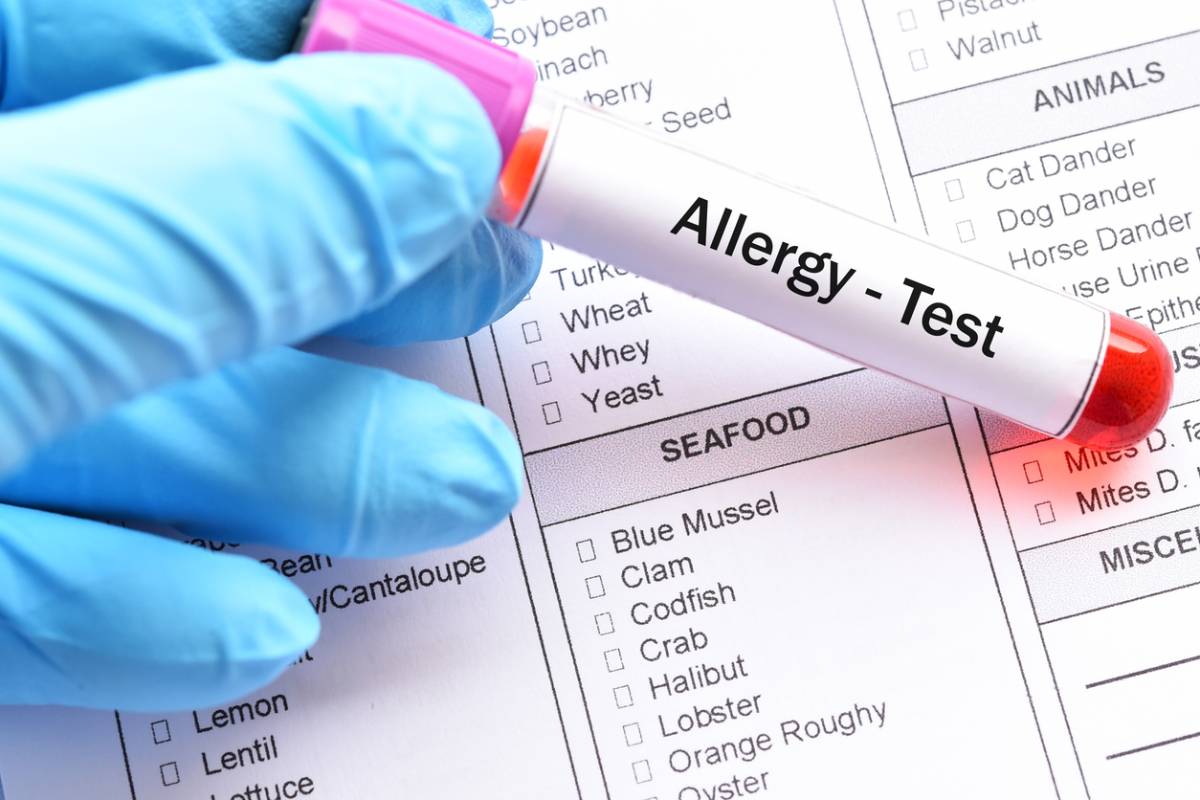 Are Allergy Tests Accurate Dr Shukla Allergy Blog